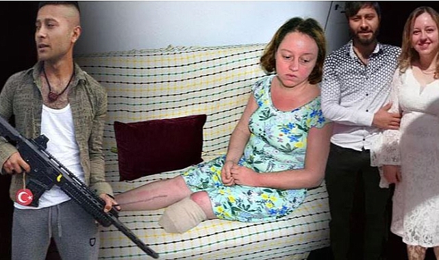 Eşini vurup bacağının kesilmesine neden oldu 13 yıl 6 ay hapse çarptırıldı